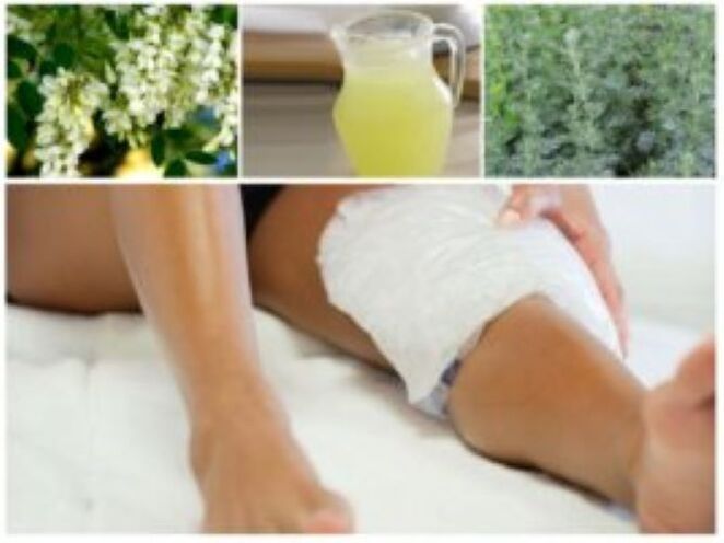 Barizeak tratatzeko folk metodo oso eraginkorra konpresak erabiltzea da.